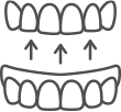 line drawing of implant supported overdentures