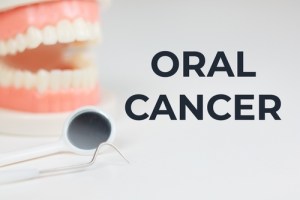 Orla cancer with scope and teeth
